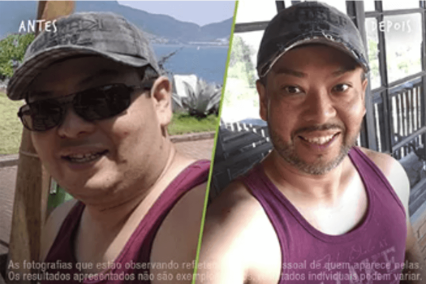 Fotos Antes e Depois 864x576 (10) (1)