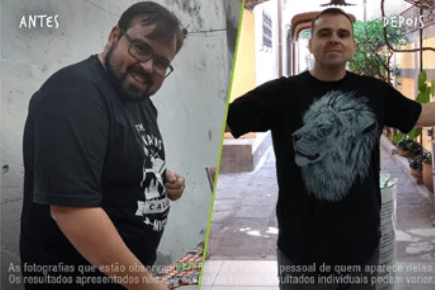 Fotos Antes e Depois 864x576 (11) (1)