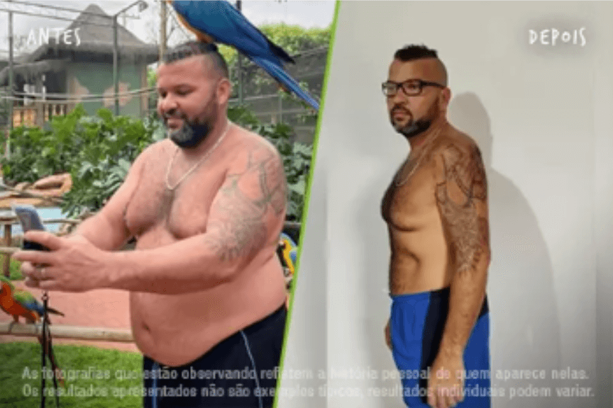 Fotos Antes e Depois 864x576 (13) (1)