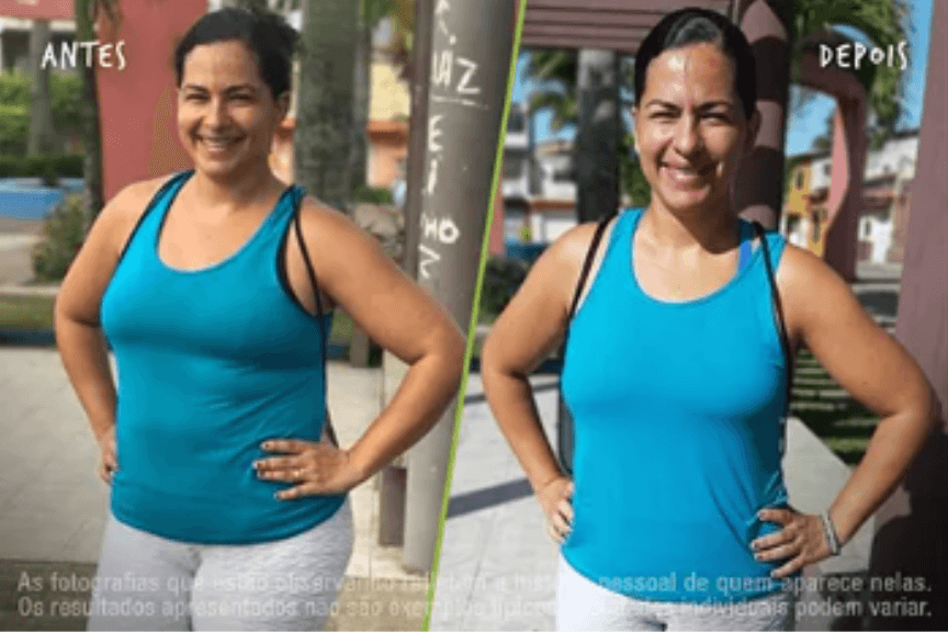 Fotos Antes e Depois 864x576 (14) (1)