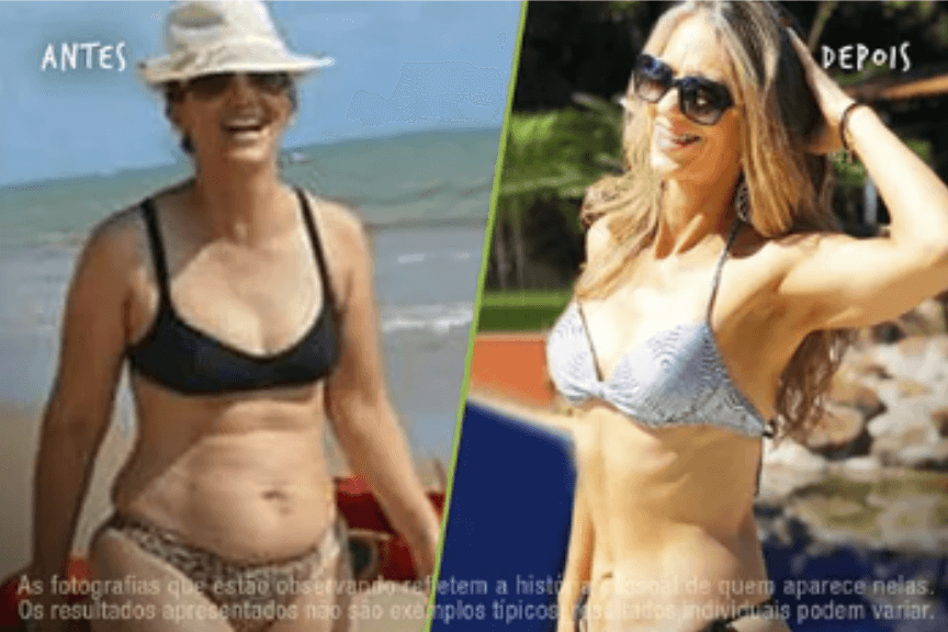 Fotos Antes e Depois 864x576 (15) (1)