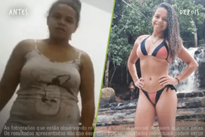 Fotos Antes e Depois 864x576 (16) (1)