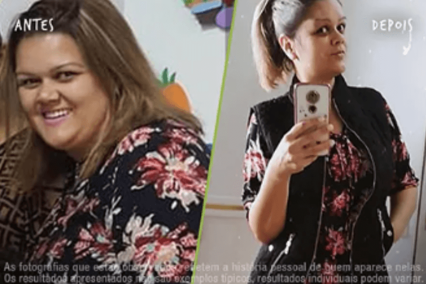 Fotos Antes e Depois 864x576 (17) (1)