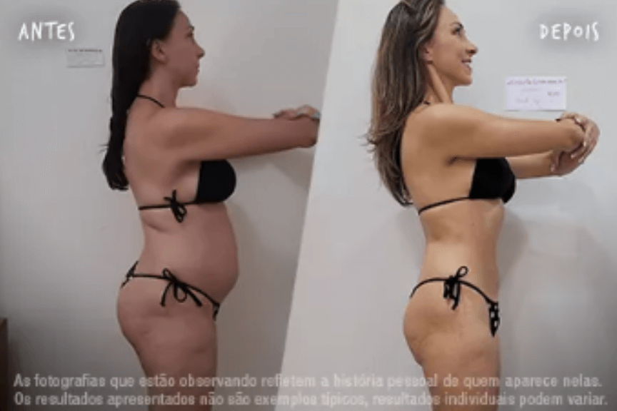 Fotos Antes e Depois 864x576 (19) (1)