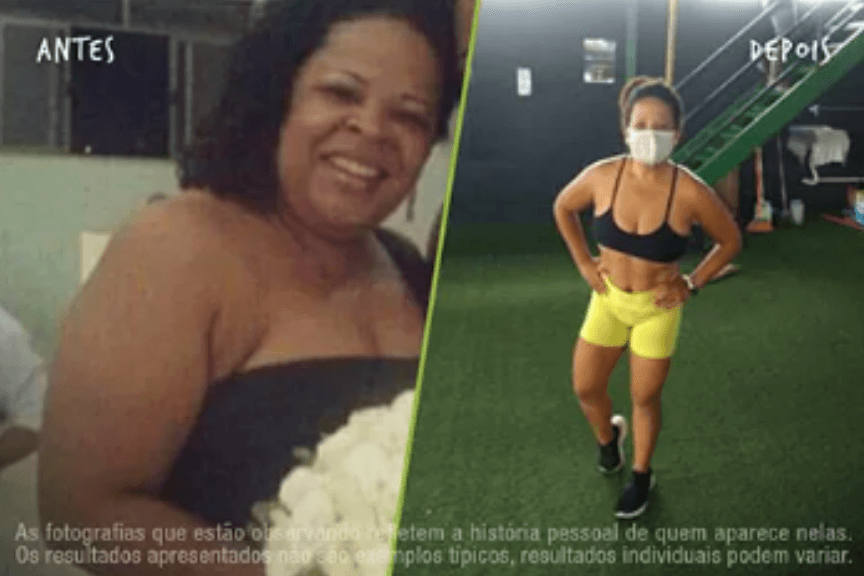 Fotos Antes e Depois 864x576 (20) (1)