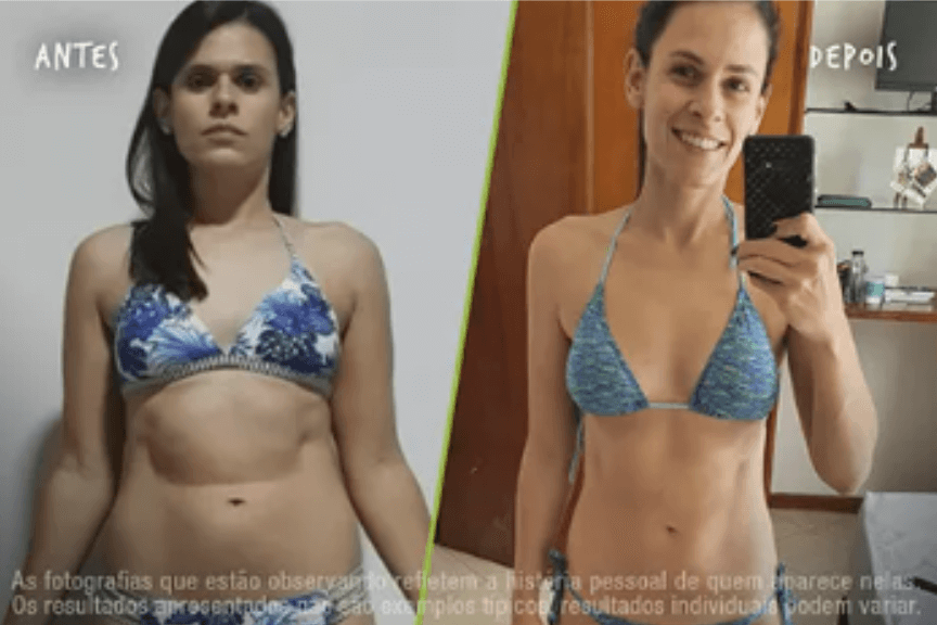 Fotos Antes e Depois 864x576 (21) (1)