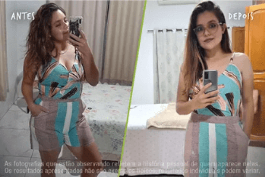 Fotos Antes e Depois 864x576 (22)
