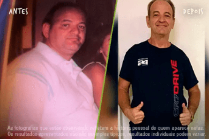 Fotos Antes e Depois 864x576 (5) (1)